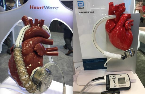 FDA Recalls Heart Devices Amid Safety Concerns. Credit | Dave Fornell